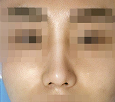 현대미학베스트셀피