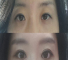 현대미학베스트셀피