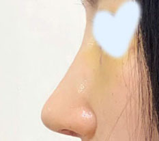 현대미학베스트셀피