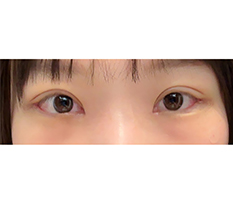 현대미학베스트셀피
