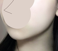 현대미학베스트셀피