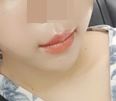 현대미학베스트셀피
