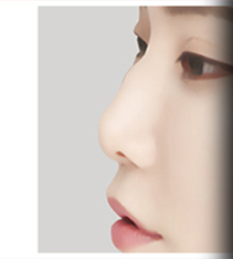 매부리코 측면 사례 3