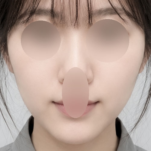 실리프팅 후기