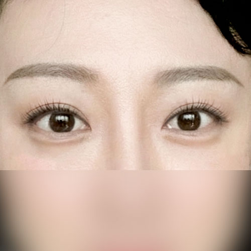 눈재 리뷰 남겨야지