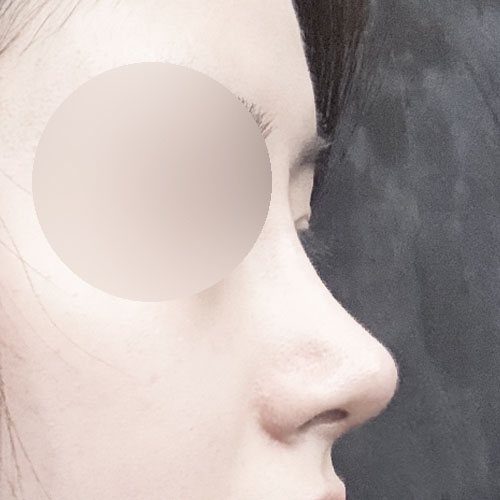 코 넘 이쁘다