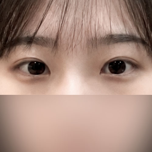 첫눈 후기야