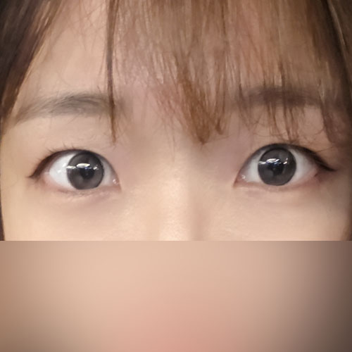 처음으로 쌍수했어!