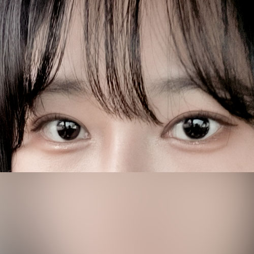 수술한지 벌써 3개월 지났어요 ㅋㅋ