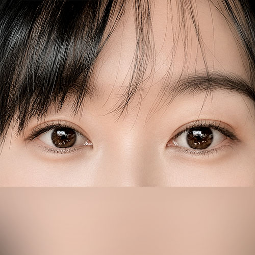 눈재수술 다신 없어