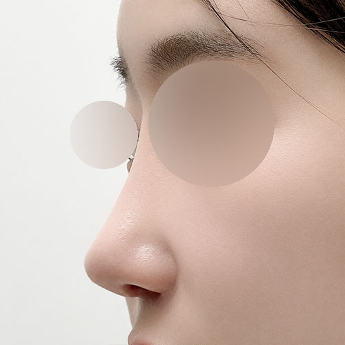 코 마음에 들어