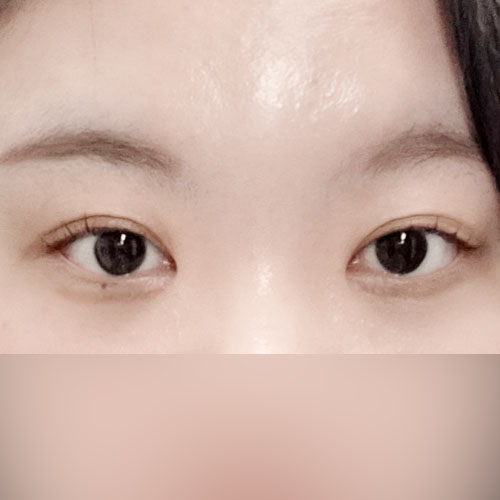 컴플렉스 탈출