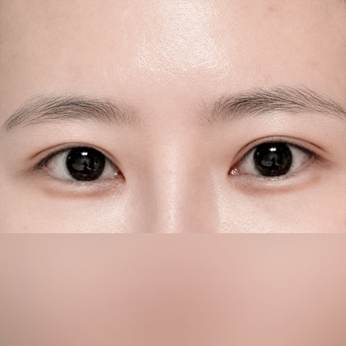 눈재하길 잘한 것 같음