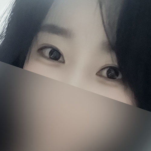 듀얼트임+쌍수 후기