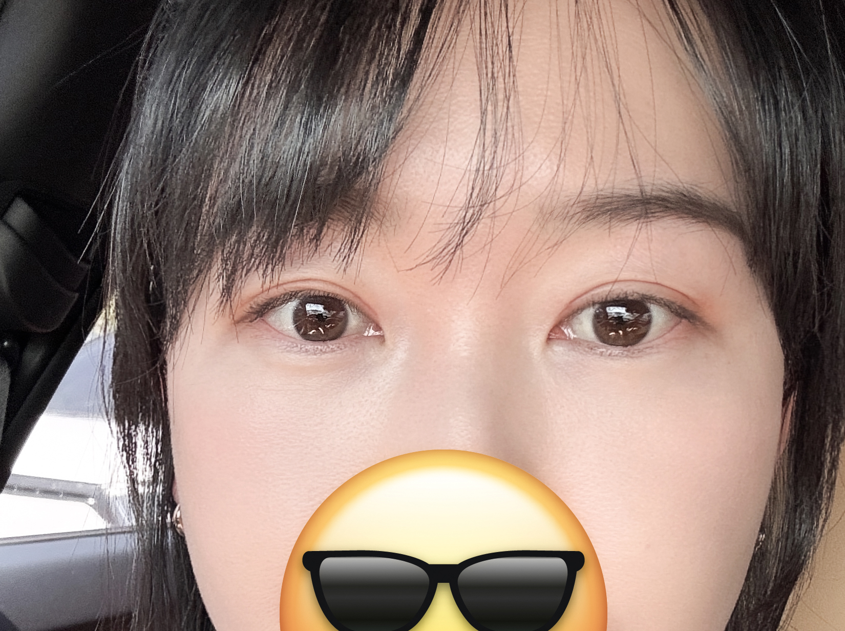 눈재 2개월차 후기