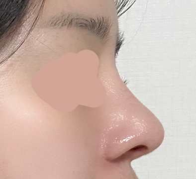 스트레스 받았는데 다행이예요