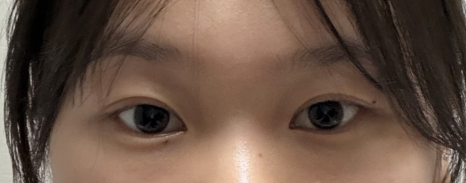 짝눈 스트레스 끝