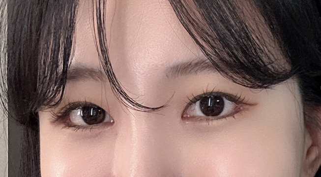 현대미학에서 쌍수한 썰 후기 끓여옴ㅋㅋ