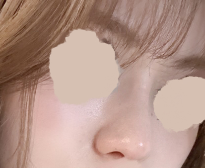 취준생 성형하다.