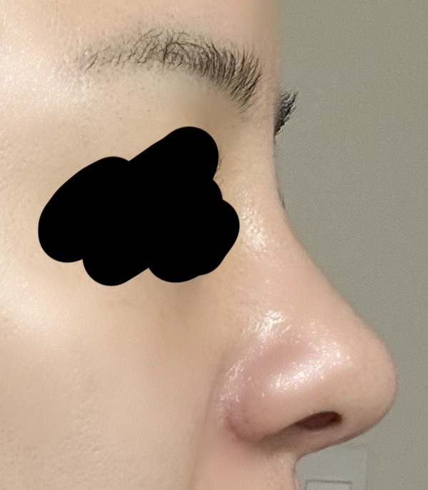 코 깔끔하죠?