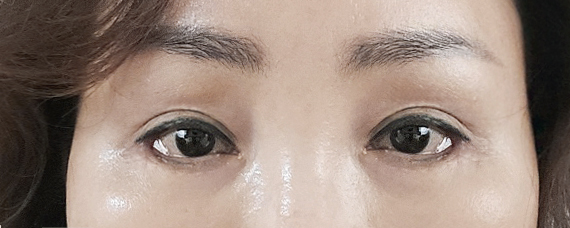 이마거상 하길 잘했어요