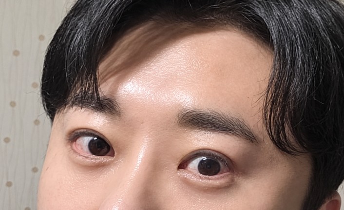 이제 마지막 수술이겠지요?